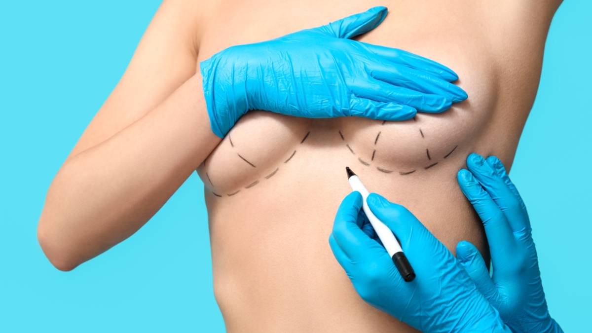 Mamoplastia